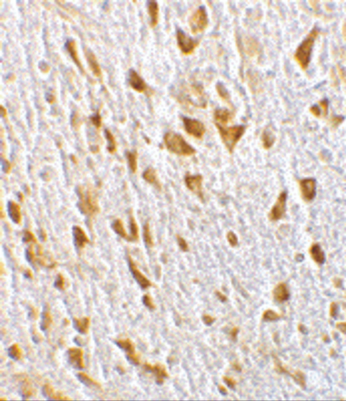 Immunohistochemistry of PIKE in mouse brain tissue with PIKE antibody at 10 ug/mL.