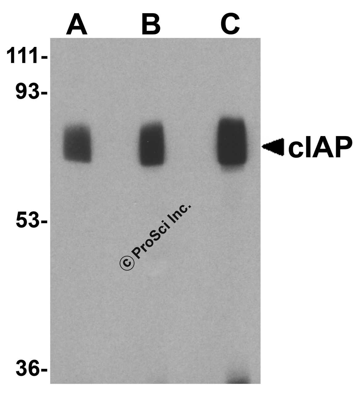 Figure 1 Western Blot Validation in Human Lung Lysate
Loading: 15 &#956;g of lysates per lane.
Antibodies: cIAP 3325 (A: 1 &#956;g/mL, B: 2 &#956;g/mL and C: 4 &#956;g/mL ) , 1h incubation at RT in 5% NFDM/TBST.
Secondary: Goat anti-rabbit IgG HRP conjugate at 1:10000 dilution.