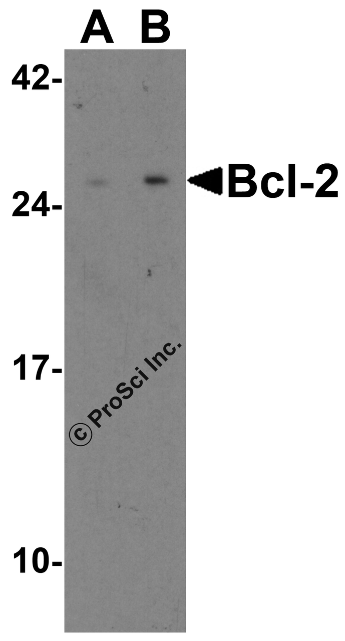 Figure 1 Western Blot Validation in Human and Mouse Cell Lines 
Loading: 15 &#956;g of lysates per lane.
Antibodies: Bcl-2 3335, (2 &#956;g/mL) , 1h incubation at RT in 5% NFDM/TBST.
Secondary: Goat anti-rabbit IgG HRP conjugate at 1:10000 dilution.
Lane A: Human Daudi cells
Lane B: Mouse A-20 cells