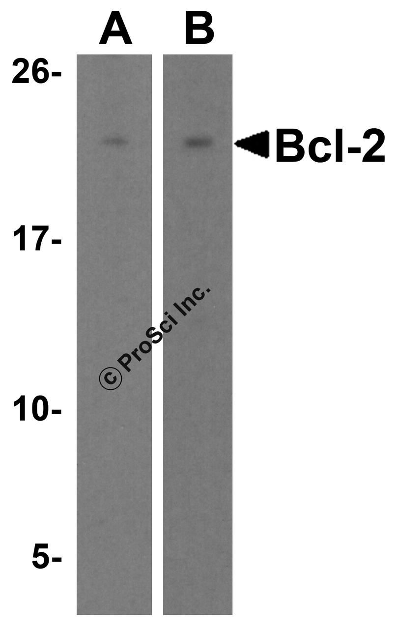 Figure 1 Western Blot Validation in Human and Mouse Cell Lines
Loading: 15 &#956;g of lysates per lane.
Antibodies: Bcl-2 3337, (2 &#956;g/mL) , 1h incubation at RT in 5% NFDM/TBST.
Secondary: Goat anti-rabbit IgG HRP conjugate at 1:10000 dilution.
Lane A: Human Daudi cells
Lane B: Mouse A-20 cells