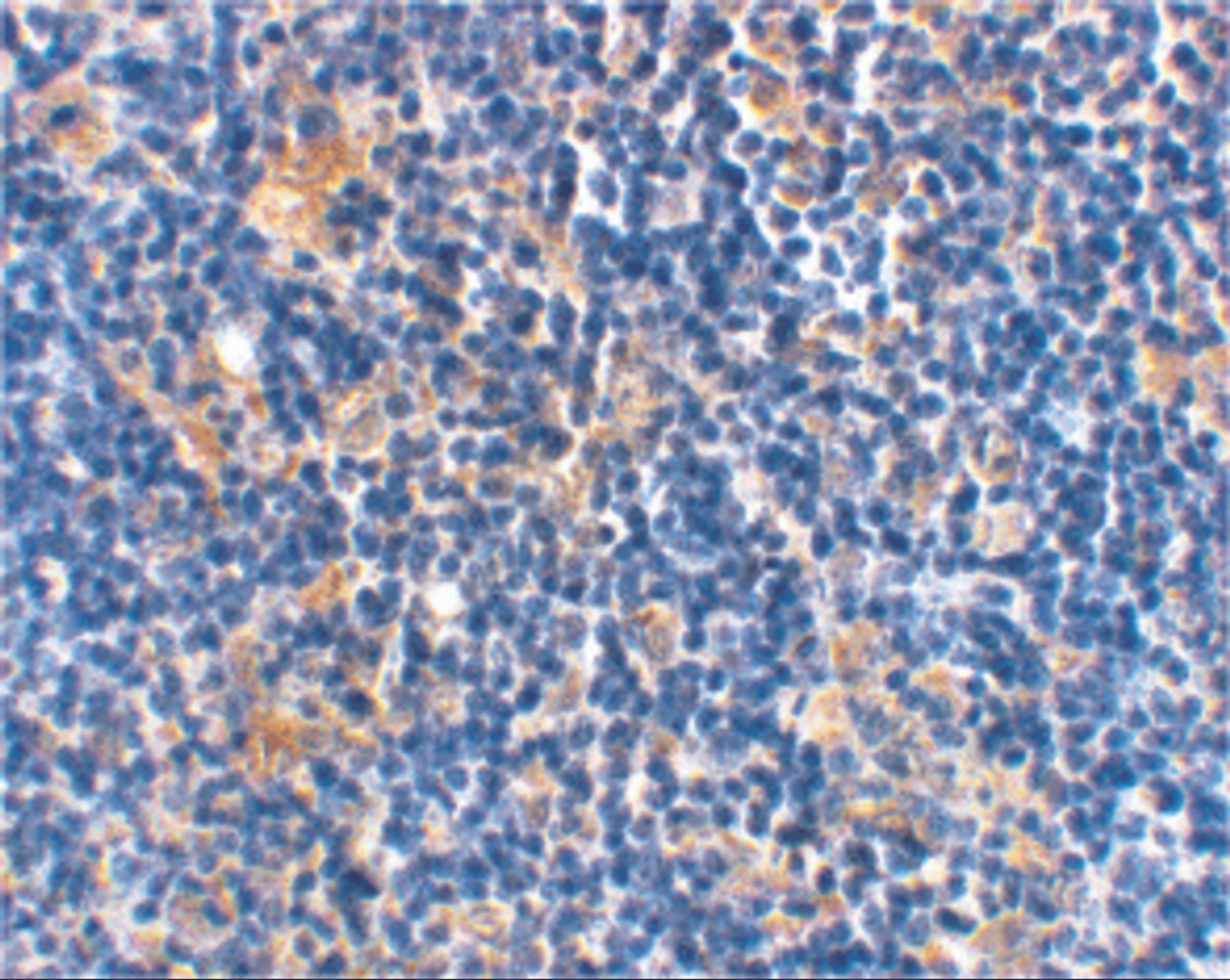 Immunohistochemical staining of rat thymus using Bad at 2 ug/mL.