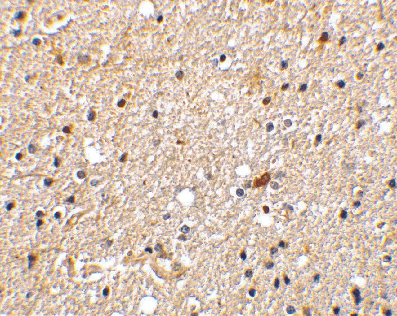 Immunohistochemistry of NADE in human brain tissue with NADE antibody at 2 ug/mL.