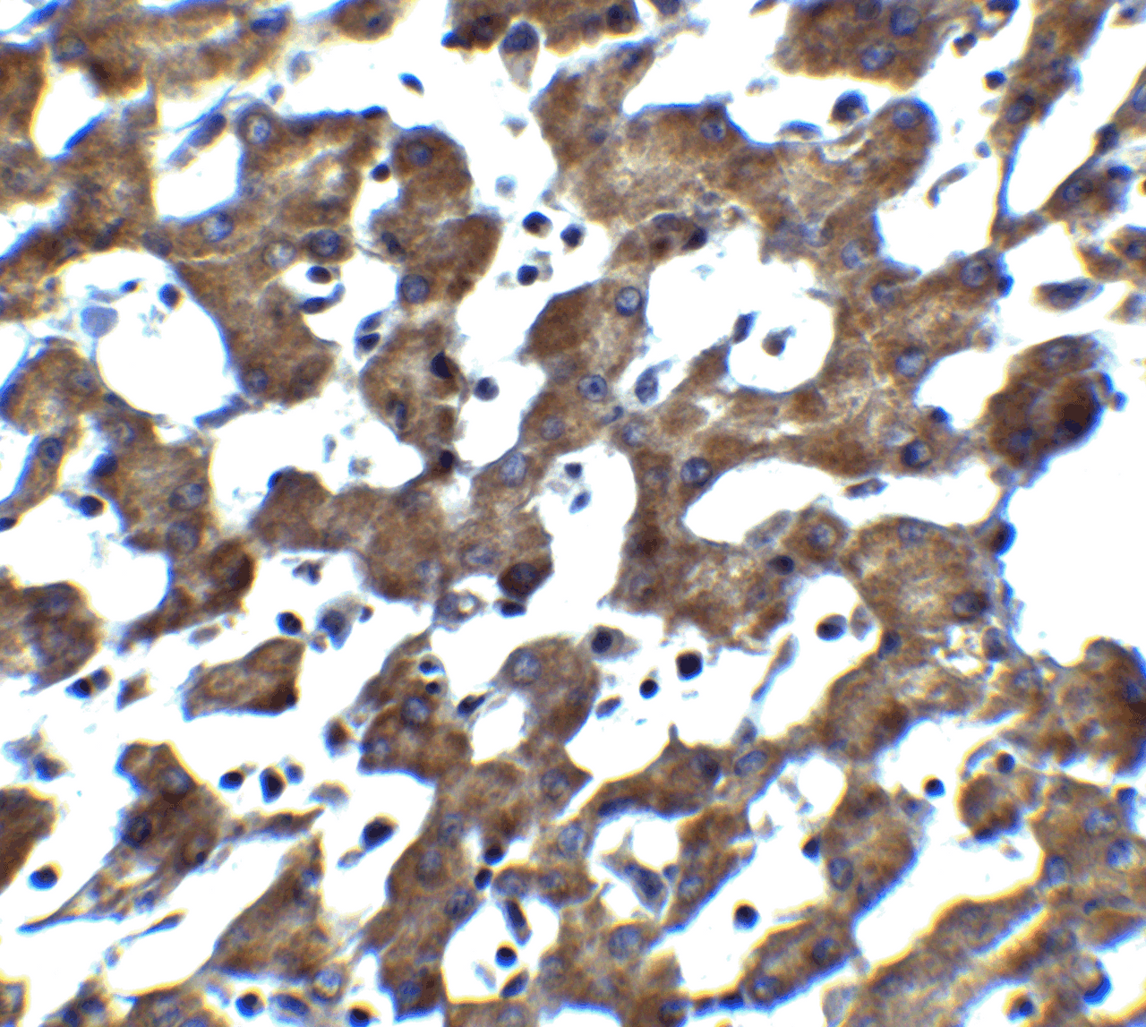 Immunohistochemistry of ST2 in human liver tissue with ST2 antibody at 5 ug/mL.