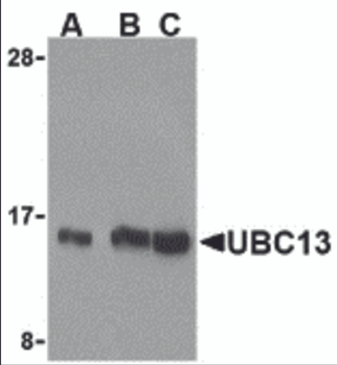 Western blot analysis of UBC13 in human small intestine cell lysates with UBC13 antibody at (A) 0.5, (B) 1, and (C) 2 &#956;g/mL.