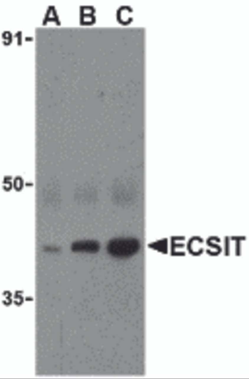 Western blot analysis of ECSIT in human heart cell lysates with ECSIT antibody at (A) 0.5, (B) 1, and (C) 2 &#956;g/mL.