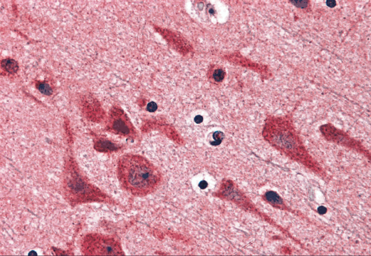 Immunohistochemistry of TAB2 in human brain tissue with TAB2 antibody at 5 &#956;g/mL.