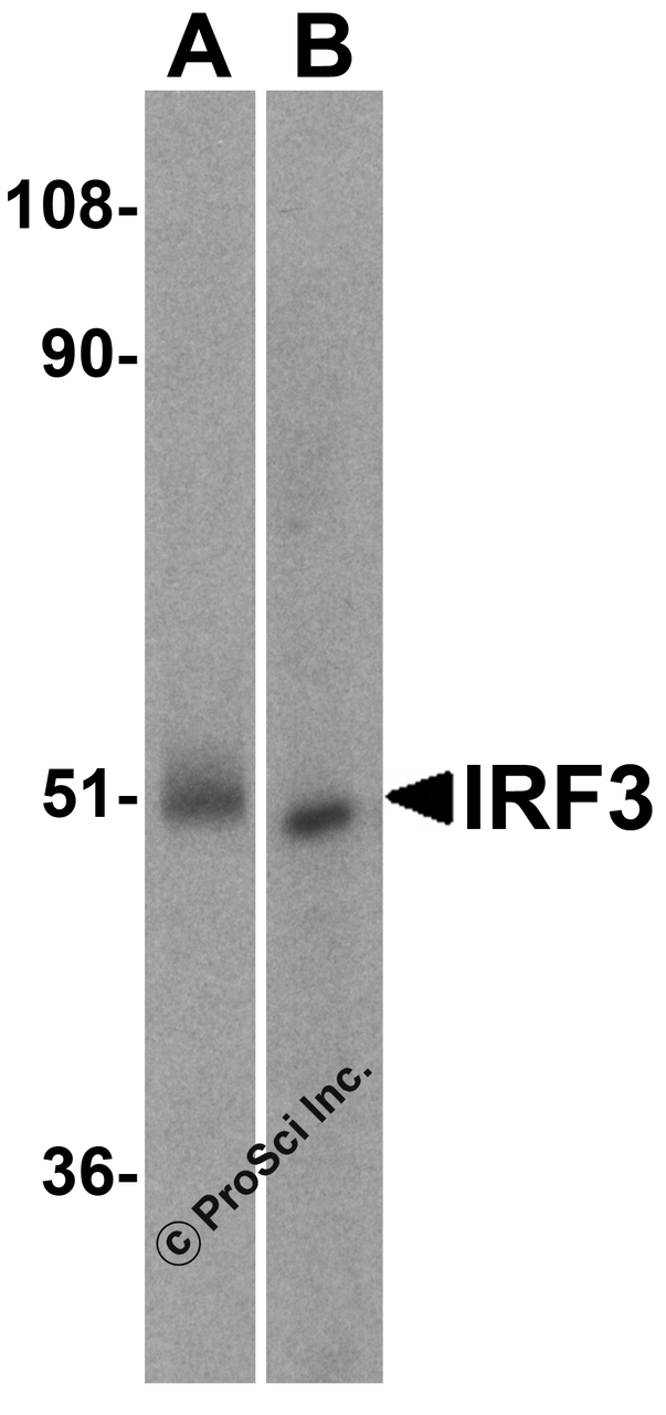 Western blot analysis of IRF3 in (A) human kidney and (B) rat kidney lysate with IRF3 antibody at 1 &#956;g/mL..