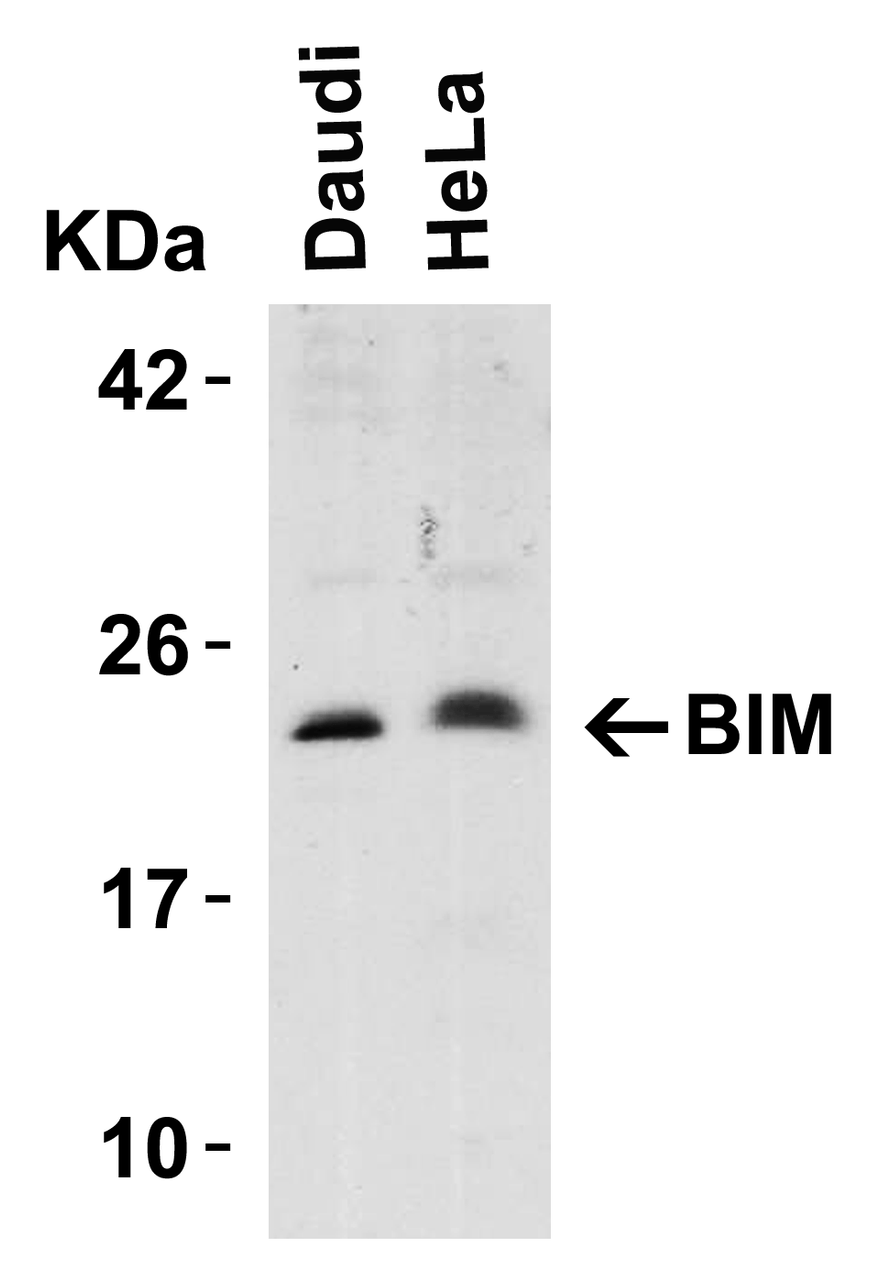 Figure 1 Western Blot Validation in Human Cell Lines
Loading: 15 &#956;g of lysates per lane.
Antibodies: BIM 3405, (5 &#956;g/mL) , 1h incubation at RT in 5% NFDM/TBST.
Secondary: Goat anti-rabbit IgG HRP conjugate at 1:10000 dilution.