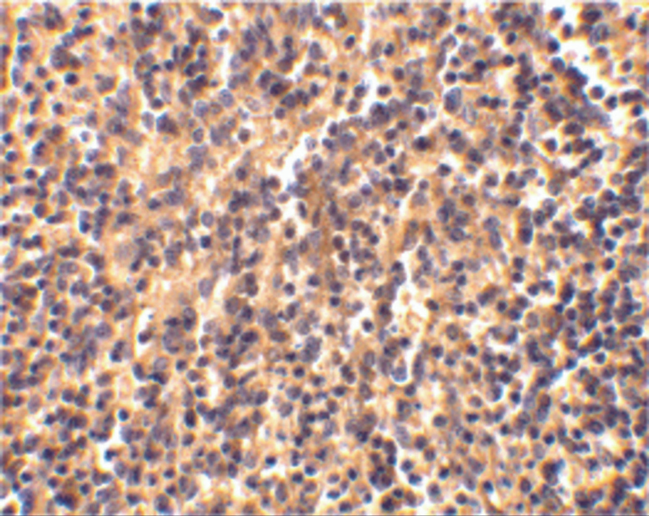Immunohistochemical staining of human spleen tissue using caspase-4 antibody at 2 ug/mL.