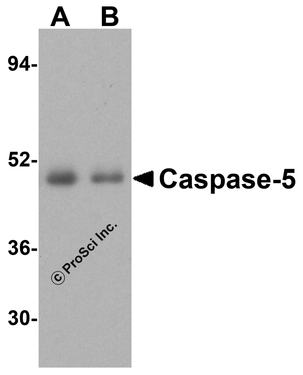 Western blot analysis of Caspase-5 in (A) human spleen tissue and (B) human thymus lysate with Caspase-5 antibody at 1 ug/mL.