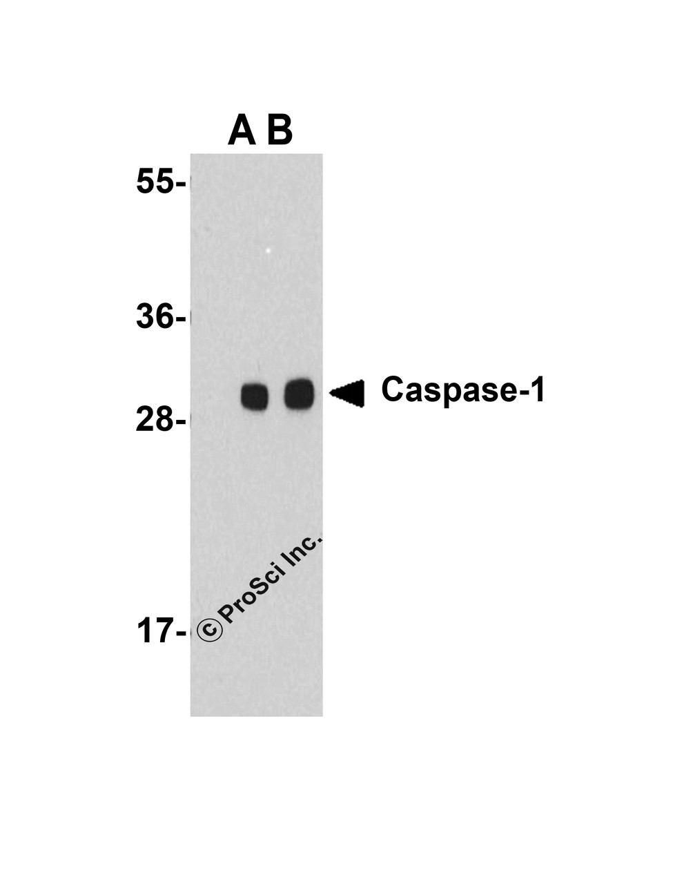 Western blot analysis of Caspase-1 in human heart cell lysate with Caspase-1 antibody at (A) 1 and (B) 2 &#956;g/mL.