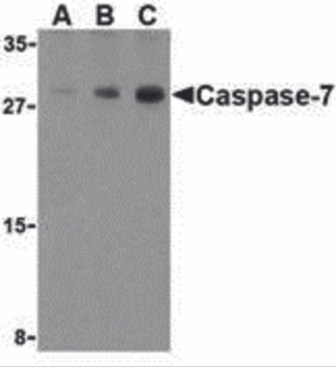 Western blot analysis of Caspase-7 in human skeletal muscle cell lysate with Caspase-7 antibody at (A) 0.5, (B) 1, and (C) 2 &#956;g/mL.