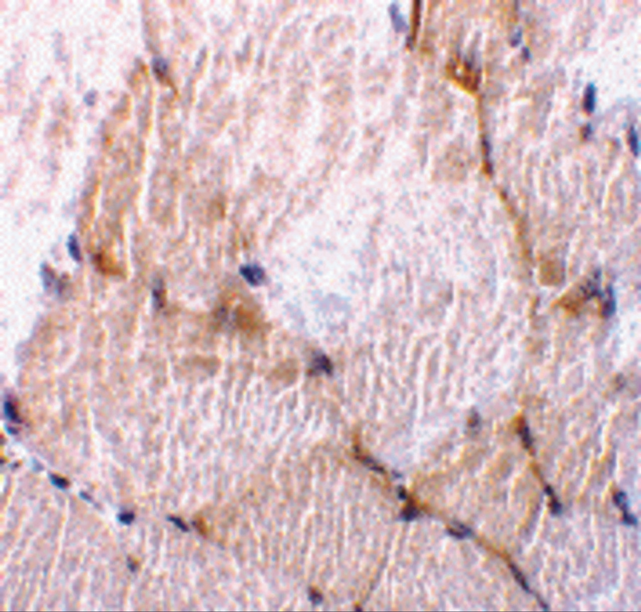 Immunohistochemistry of caspase-7 in rat skeletal muscle tissue with caspase-7 antibody at 10 ug/mL.