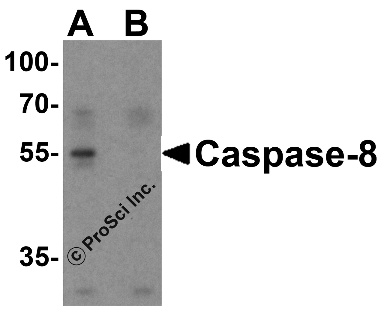 Western blot analysis of caspase-8 in Jurkat cell lysate with caspase-8 antibody at 1 &#956;g/mL in (A) the absence and (B) the presence of blocking peptide.