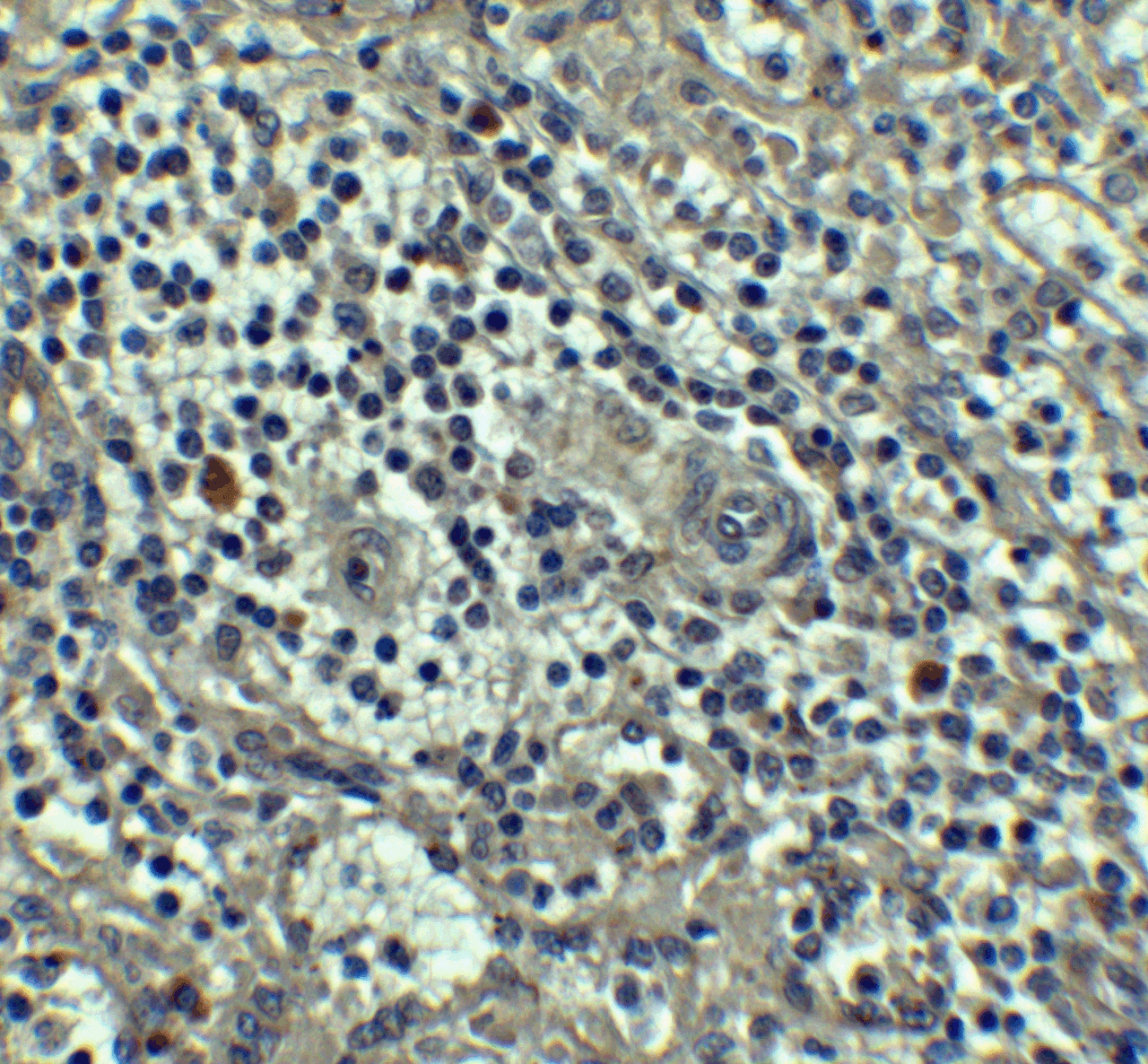 Immunohistochemistry of Caspase-8 in human spleen tissue with Caspase-8 antibody at 5 ug/mL.