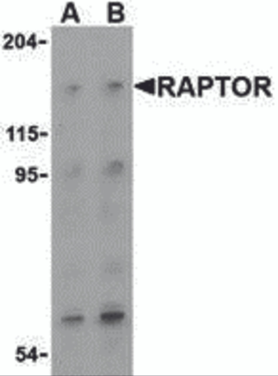 Western blot analysis of Raptor in L1210 cell lysate with Raptor (IN) antibody at (A) 2 and (B) 4 &#956;g/mL.
