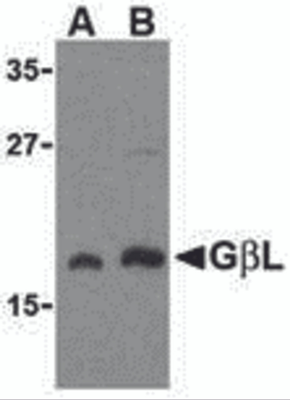 Western blot analysis of GbL in human brain cell lysate with GbL antibody at (A) 1 and (B) 2 &#956;g/mL.