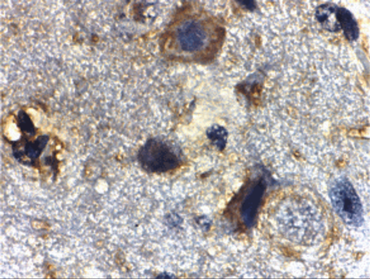 Immunohistochemistry of Rheb in mouse brain tissue with Rheb antibody at 2 ug/mL.