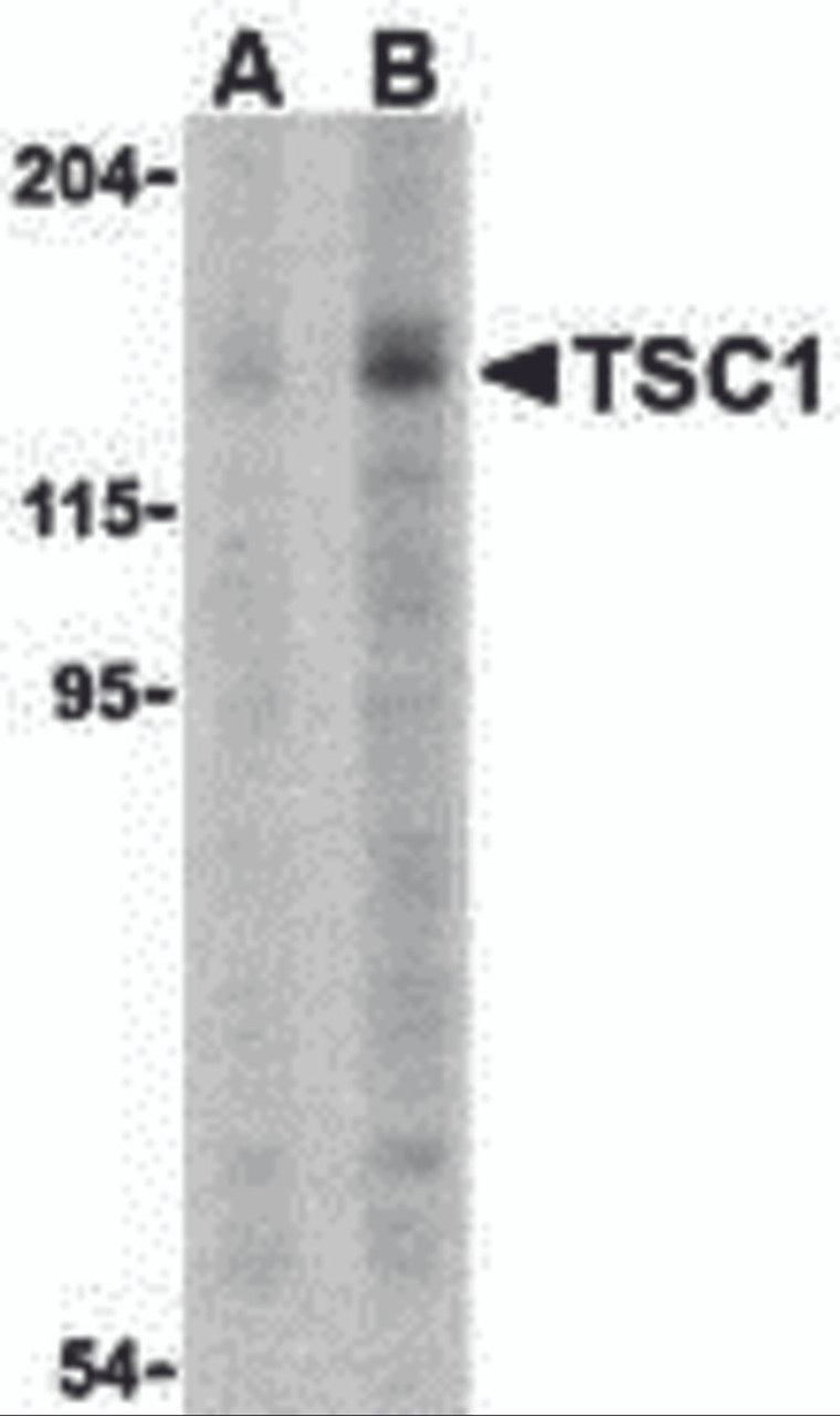 Western blot analysis of TSC1 in C2C12 cell lysate with TSC1 antibody at (A) 2 and (B) 4 &#956;g.