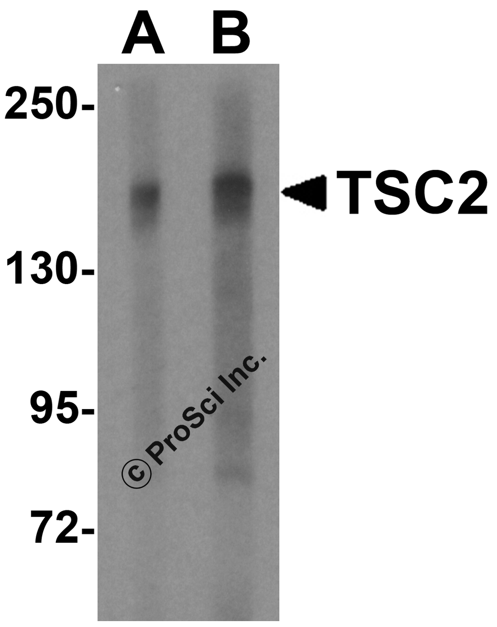 Western blot analysis of TSC2 in L1210 cell lysate with TSC2 antibody at (A) 2 and (B) 4 &#956;g/mL.