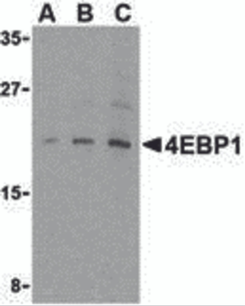 Western blot analysis of 4E-BP1 in 3T3 cell lysate with 4E-BP1 antibody at (A) 2.5, (B) 5 and (C) 10 &#956;g/mL.