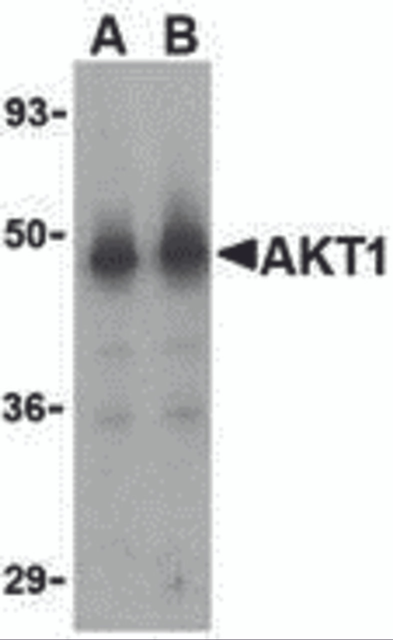 Western blot analysis of Akt1 in human liver cell lysate with Akt1 antibody at (A) 1 and (B) 2 &#956;g/mL.