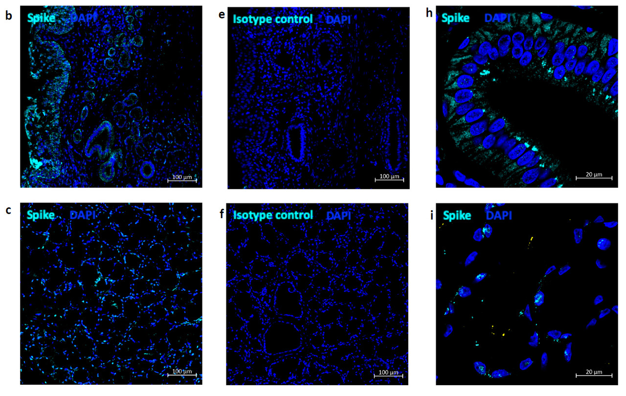 Figure 2 Immunofluorescent Validation of 3525 in SARS-CoV-2 Infected Nose and Tonsil (Singh et al., Nature Microbiology, 2021)  Multi-label confocal immunofluorescence microscopy of nasal epithelium (20X-b, 63xh) and tonsil (20X-c, 63X-i) from rhesus macaques infected with SARS-CoV-2 with SARS-CoV-2 spike-specific antibodies, 3525 ProSci Inc. (turquoise) , DAPI (blue) . Rabbit IgG isotype control antibody was
used to stain the tissues to rule out any non-specific staining (e, f) .