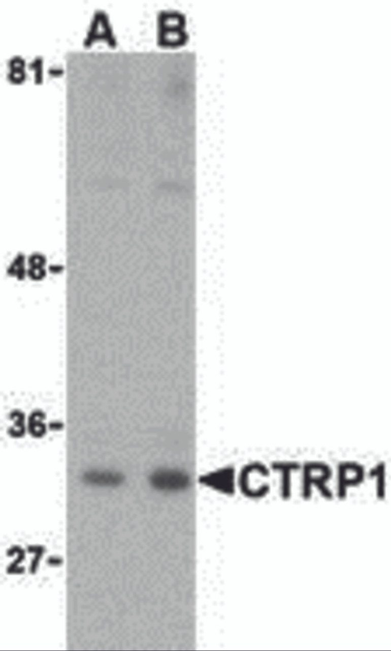 Western blot analysis of CTRP1 in MDA-MD-361 cell lysate with CTRP1 (IN) antibody at (A) 1 and (B) 2 &#956;g/mL.