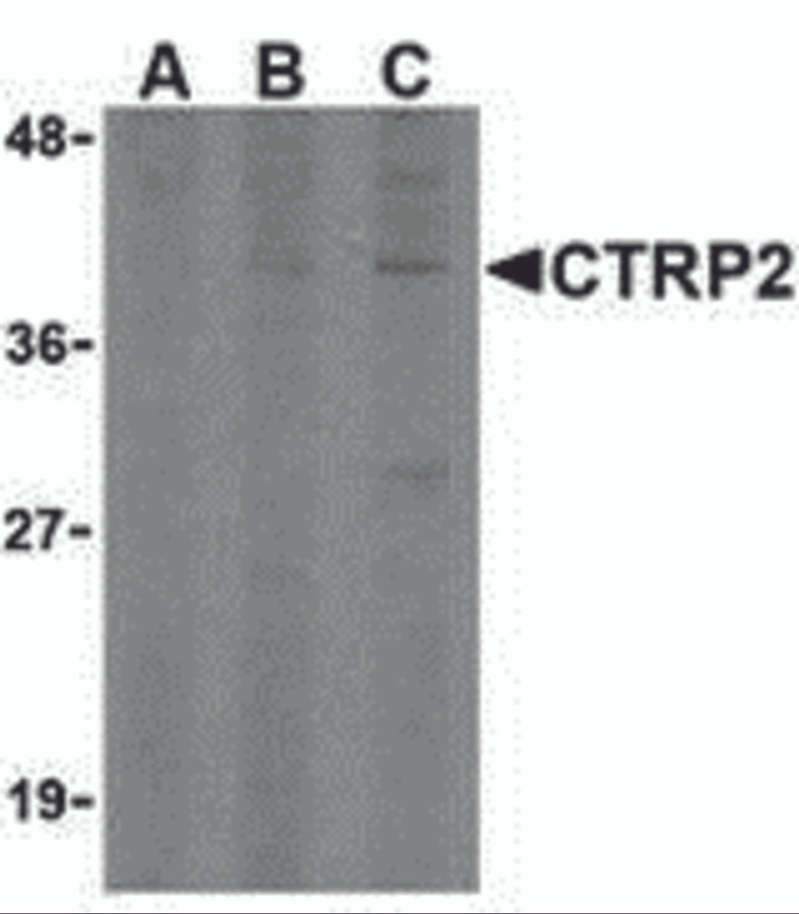 Western blot analysis of CTRP2 in 3T3 (Balb) cell lysate with CTRP2 (IN) antibody at (A) 1, (B) 2, and (C) 4 &#956;g/mL.