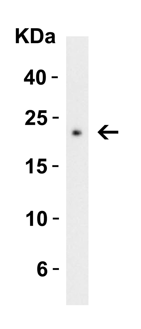 Figure 2 Western Blot Validation with Recombinant Protein
Loading: 30 ng of human CTRP3 recombinant protein per lane.
Antibodies: CTRP3, 3565 (2 ug/mL) , 1h incubation at RT in 5% NFDM/TBST.
Secondary: Goat anti-rabbit IgG HRP conjugate at 1:10000 dilution.