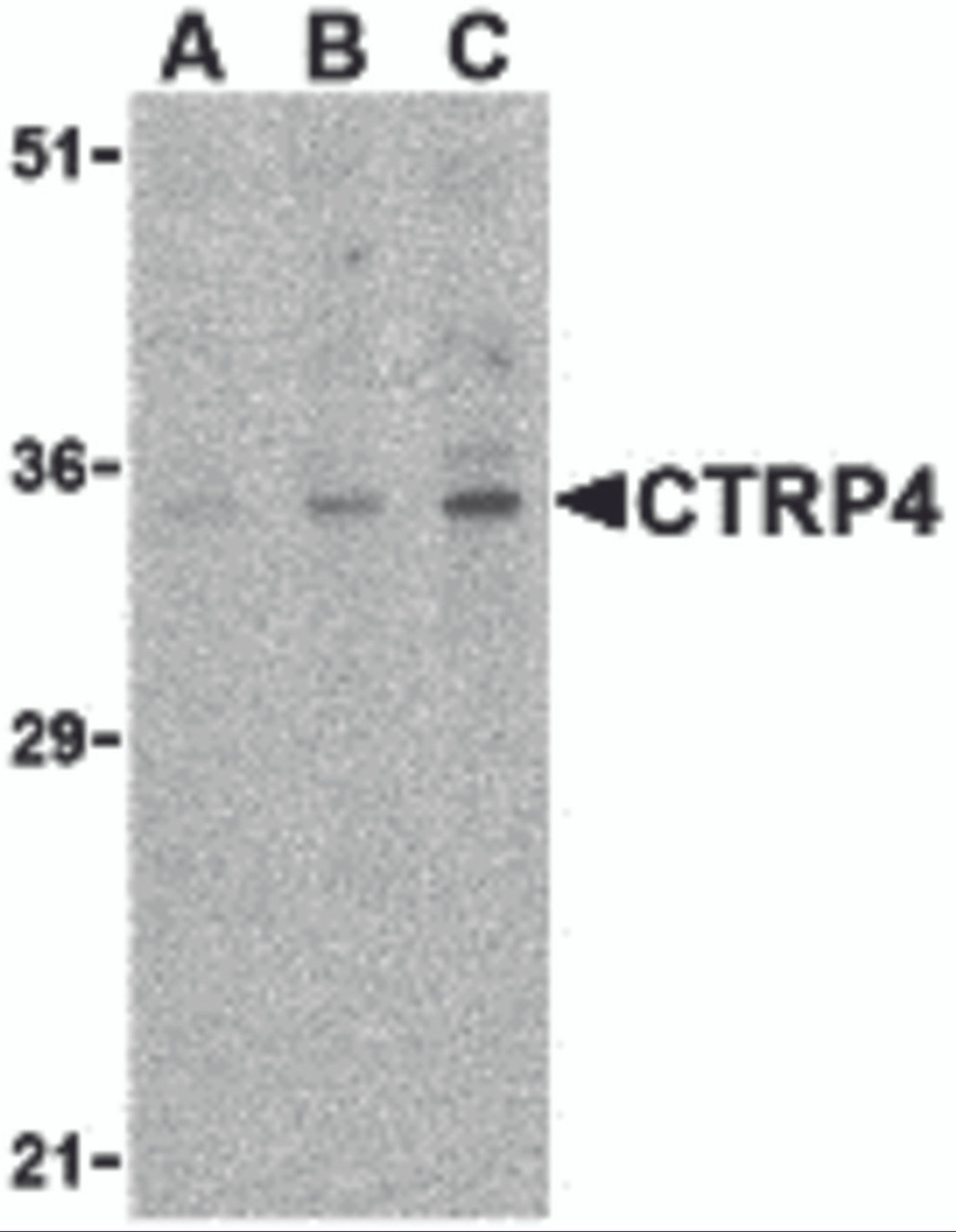 Western blot analysis of CTRP4 in rat brain cell lysate with CTRP4 antibody at (A) 1, (B) 2, and (C) 4 &#956;g/mL.