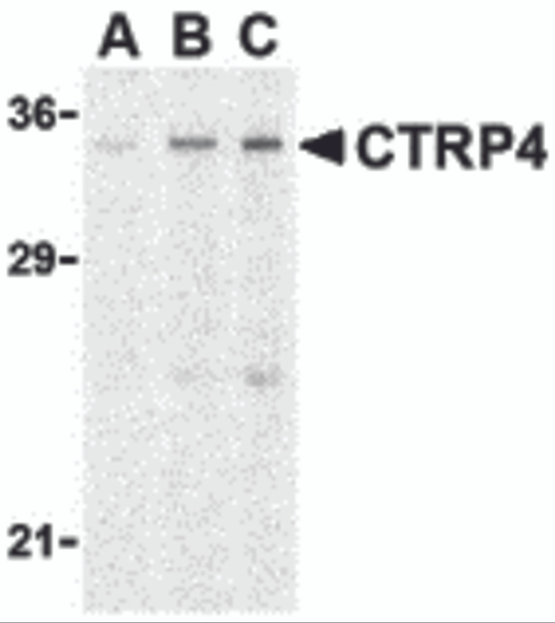 Western blot analysis of CTRP4 in rat brain cell lysate with CTRP4 antibody at (A) 1, (B) 2, and (C) 4 &#956;g/mL.