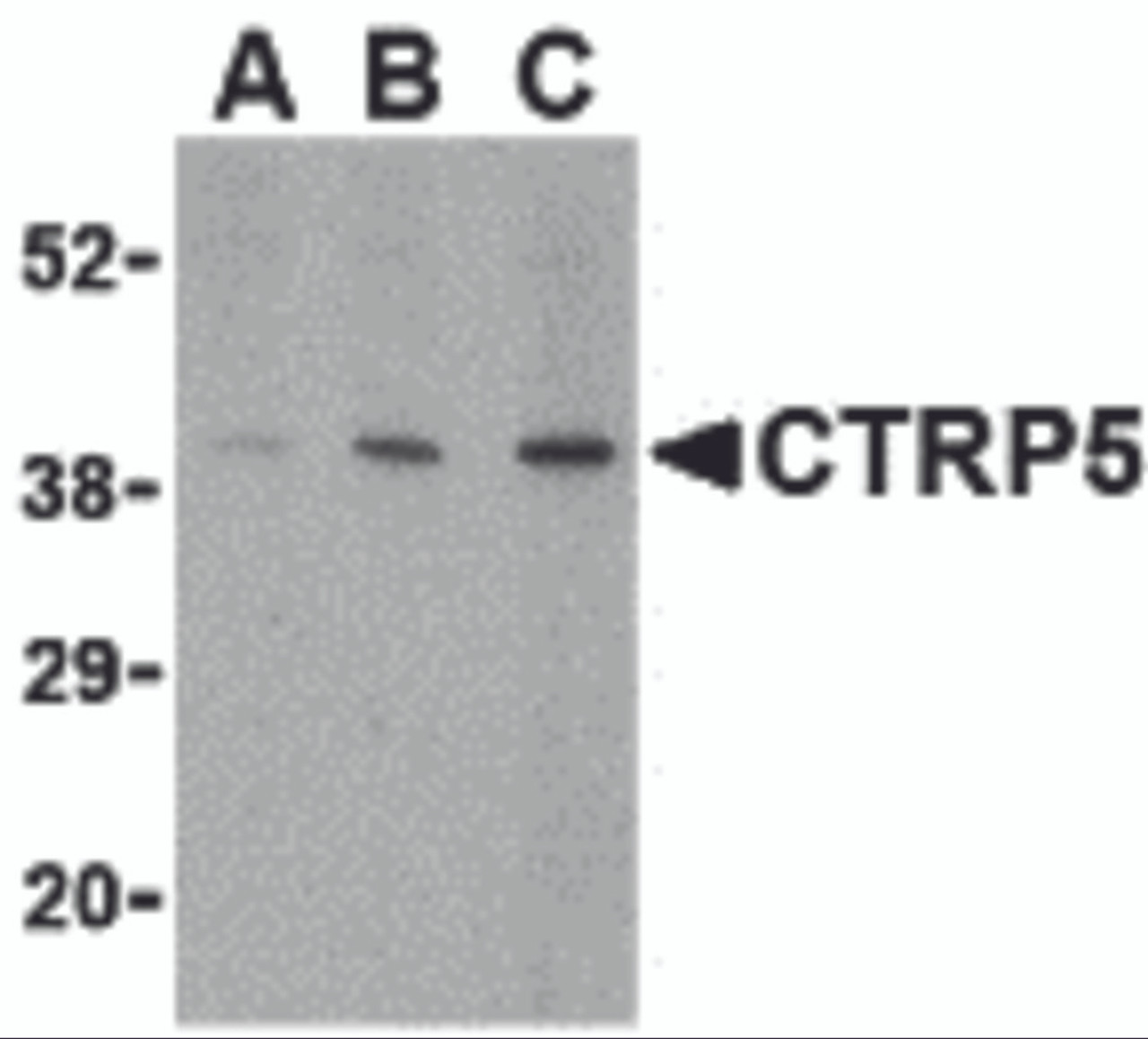 Western blot analysis of CTRP5 in caco-2 cell lysate with CTRP5 antibody at (A) 1, (B) 2, and (C) 4 &#956;g/mL.