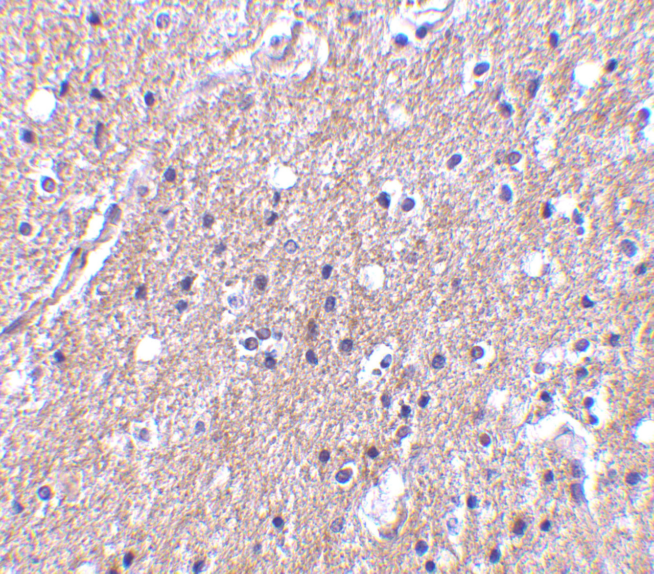 Immunohistochemistry of CTRP6 in human brain tissue with CTRP6 antibody at 10 ug/mL.