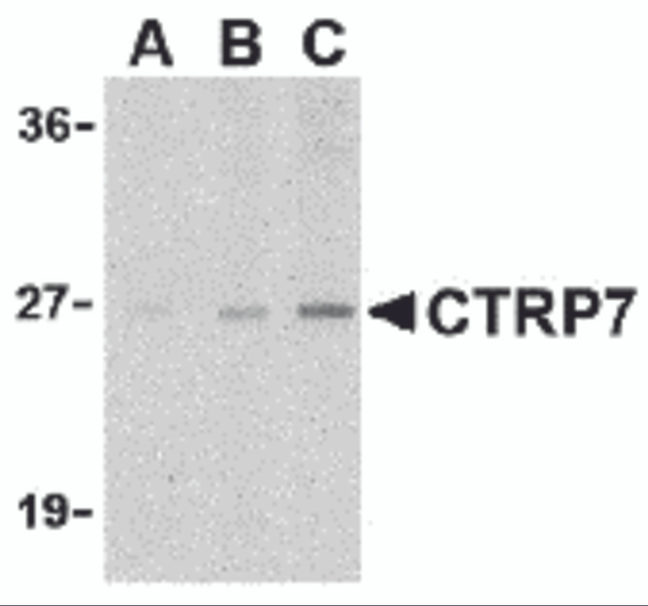 Western blot analysis of CTRP7 in 3T3 cell lysate with CTRP7 antibody at (A) 1, (B) 2, and (C) 4 &#956;g/mL.