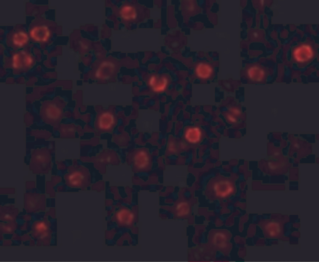 Immunofluorescence of T-cadherin in K562 cells with T-cadherin antibody at 20 ug/mL.