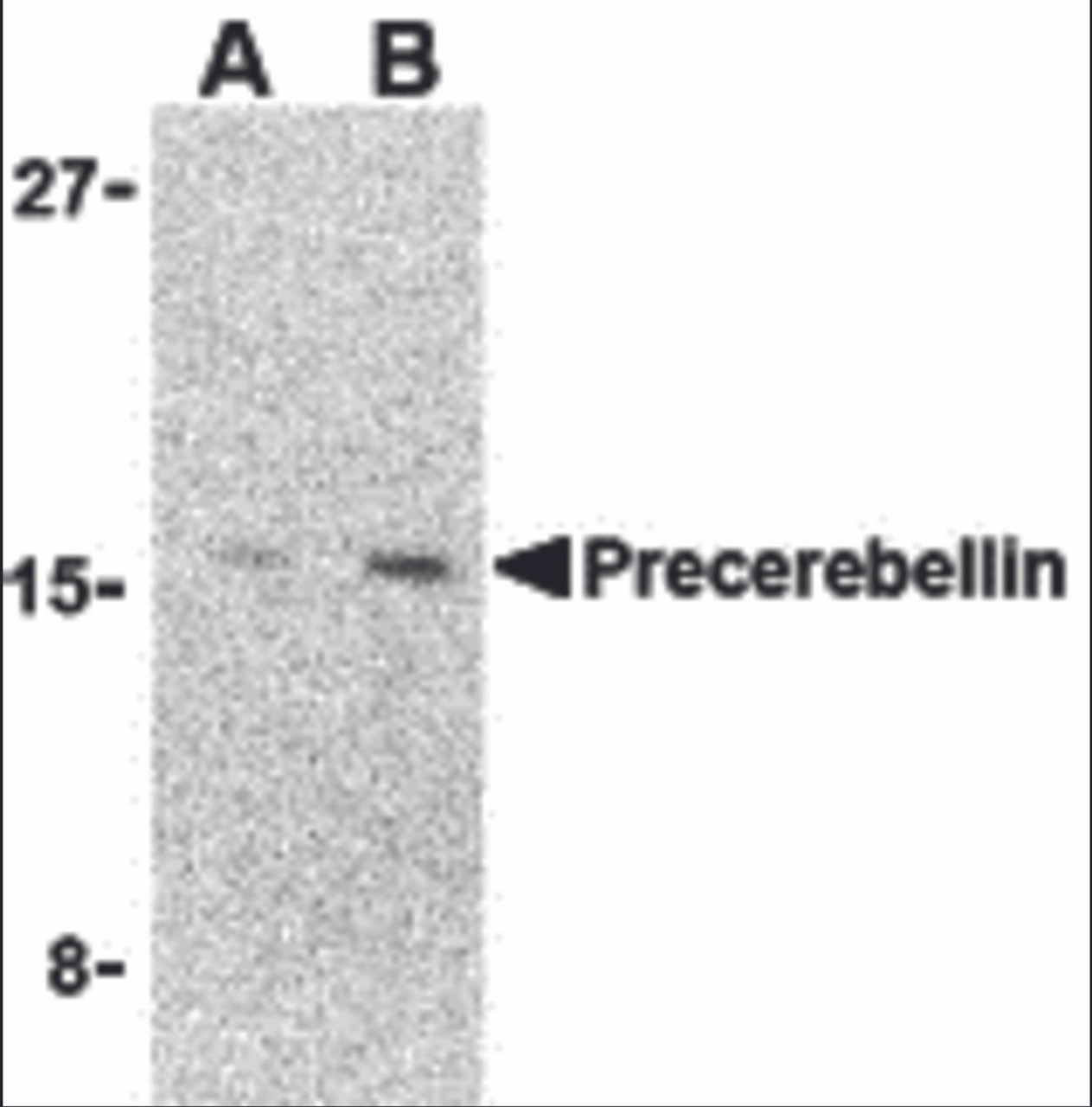 Western blot analysis of precerebellin in 293 cell lysate with precerebellin antibody at (A) 2 and (B) 4 &#956;g/mL.