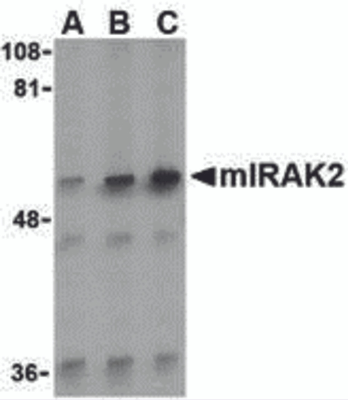 Western blot analysis of IRAK2 in A-20 whole cell lysate with IRAK2 antibody (C2) at (A) 0.5, (B) 1, and (C) 2 &#956;g/mL.