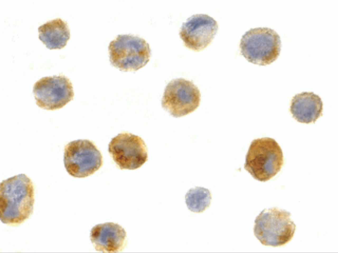 Immunocytochemistry staining of A431 cells using Beclin-1 antibody at 1 ug/mL.