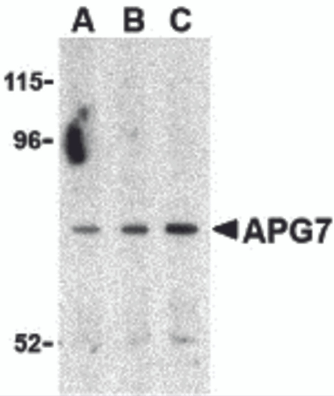 Western blot analysis of APG7 in Caco-2 cell lysate with APG7 antibody at (A) 0.5, (B) 1 and (C) 2 &#956;g/mL.