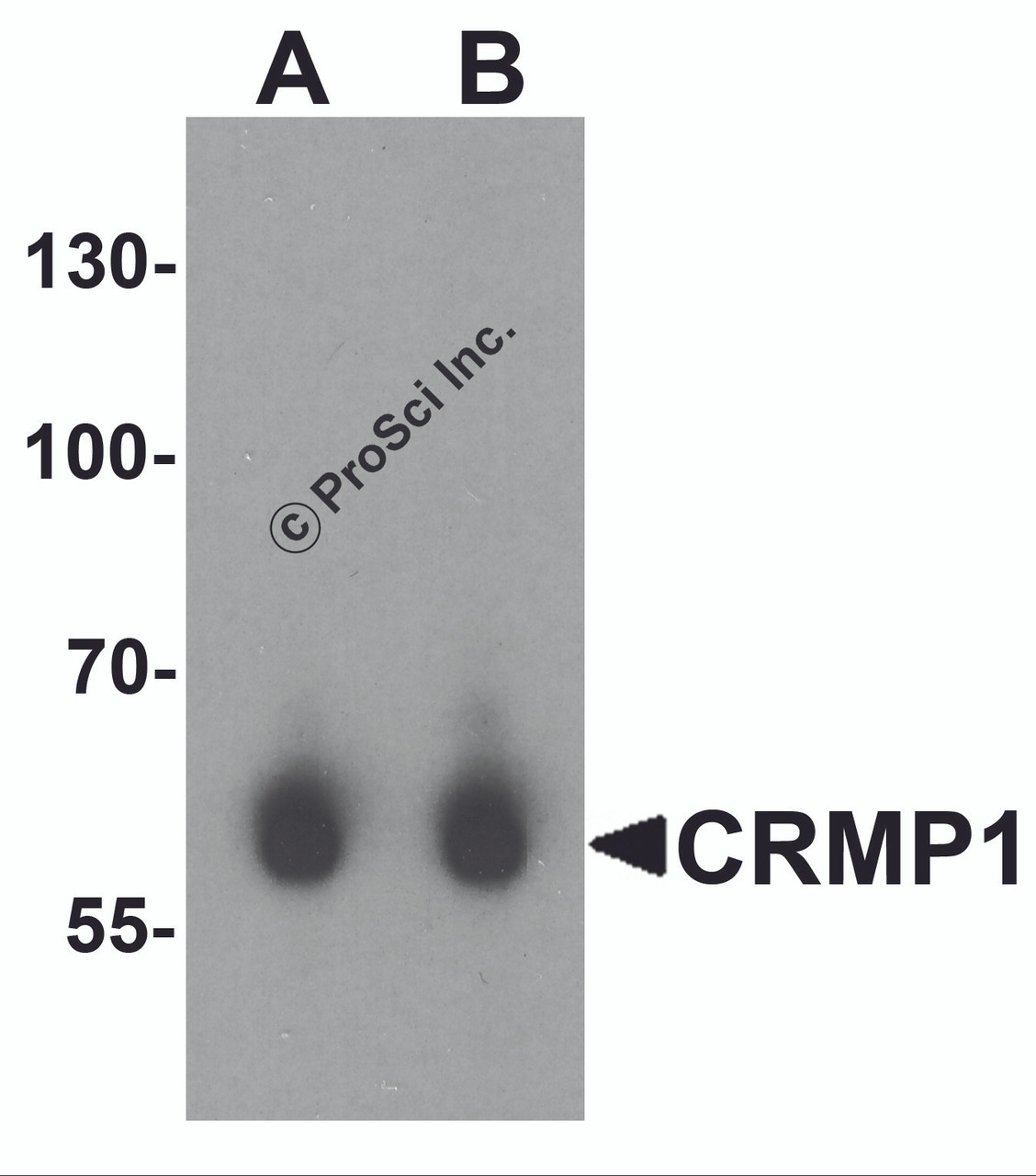 Western blot analysis of CRMP1 in human brain tissue lysate with CRMP1 antibody at (A) 1 and (B) 2 &#956;g/mL.