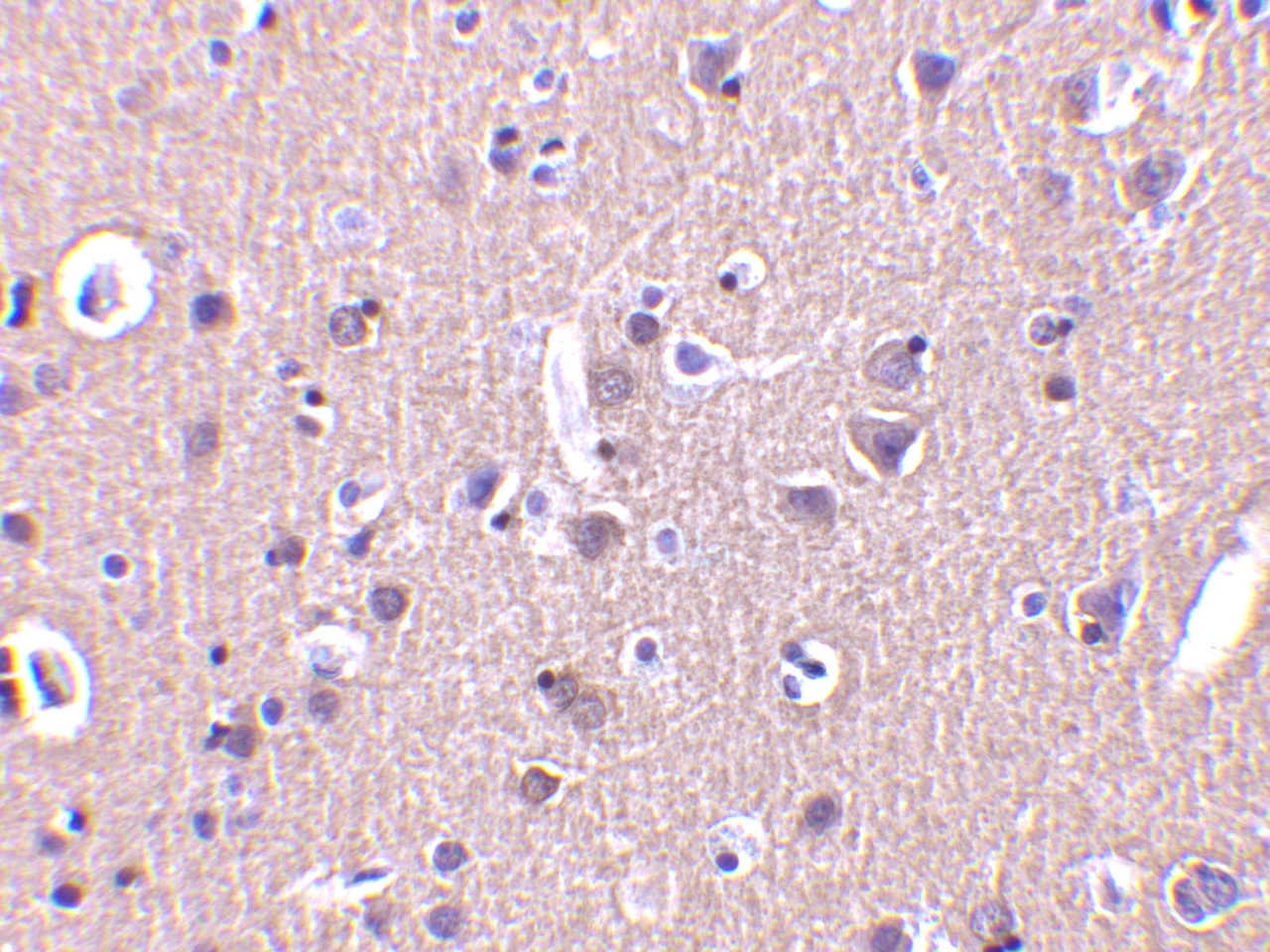 Immunohistochemistry of CRMP in human brain tissue with CRMP antibody at 2 ug/mL.