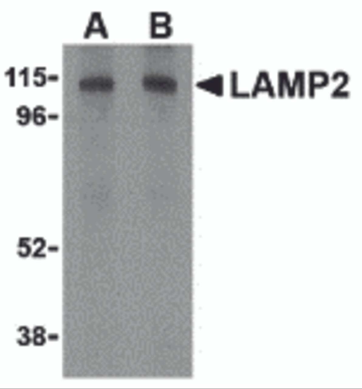 Western blot analysis of LAMP-2 in HepG2 cell lysate with LAMP-2 antibody at (A) 1 and (B) 2 &#956;g/mL.
