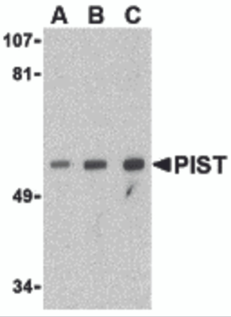 Western blot analysis of PIST in PC-3 cell lysate with PIST antibody at (A) 1, (B) 2 and (C) 4 &#956;g/mL.