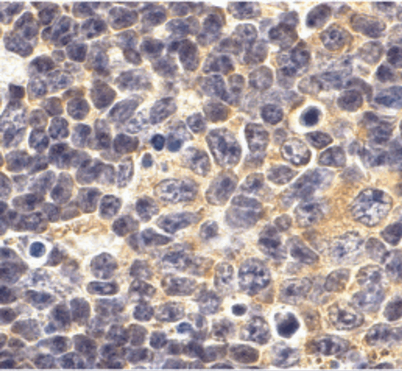 Immunohistochemistry of TLR1 in mouse spleen tissue with TLR1 antibody at 10 ug/mL.