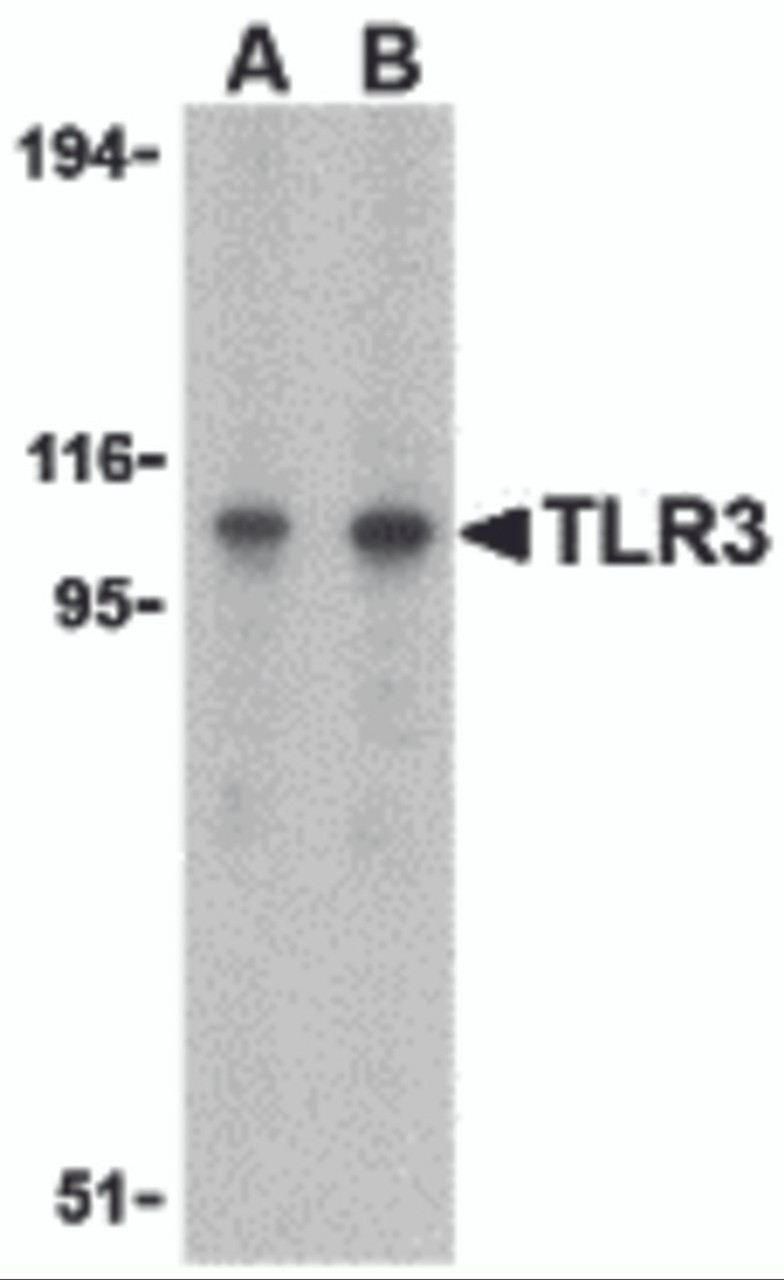 Western blot analysis of TLR3 in Daudi cell lysate with TLR3 antibody at (A) 1 and (B) 2 &#956;g/mL.
