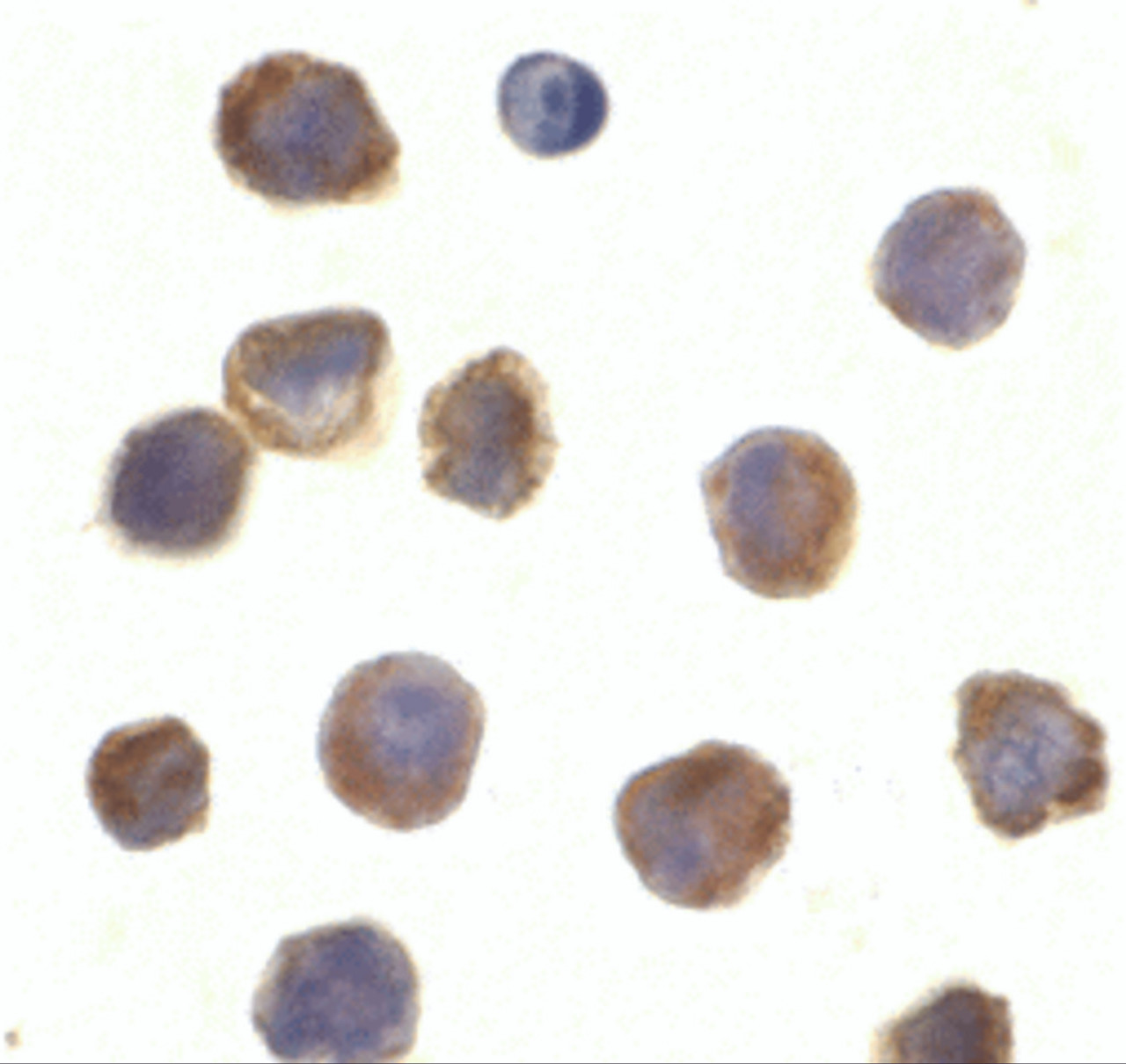 Immunocytochemistry of TLR3 in K562 cells with TLR3 antibody at 10 ug/mL.