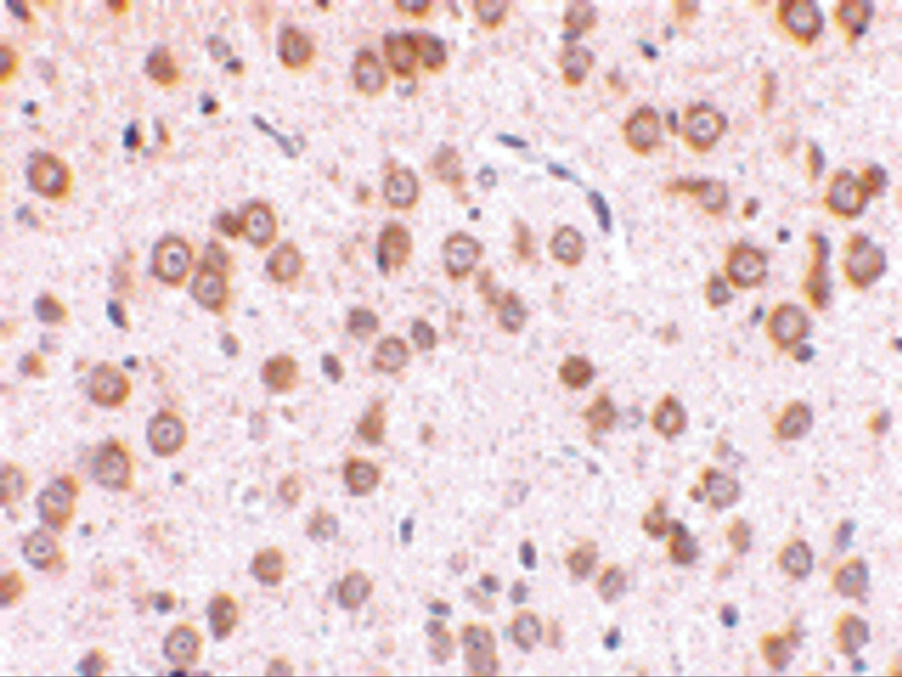 Immunohistochemistry of TLR5 in rat brain tissue with TLR5 antibody at 10 ug/mL.