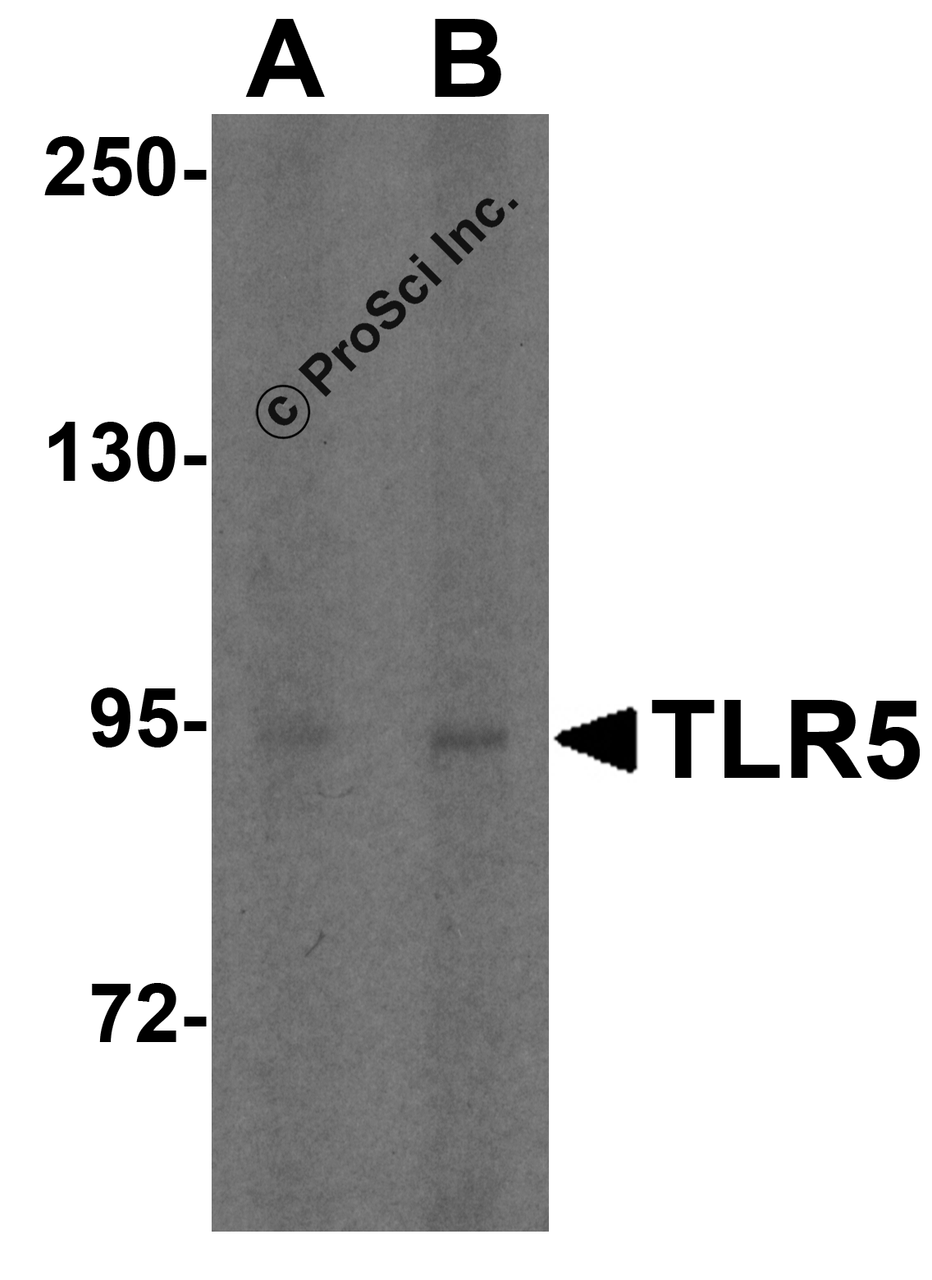 Western blot analysis of TLR5 expression in HT29 cell lysate with TLR5 antibody at (A) 1 and (B) 2 &#956;g/ml.