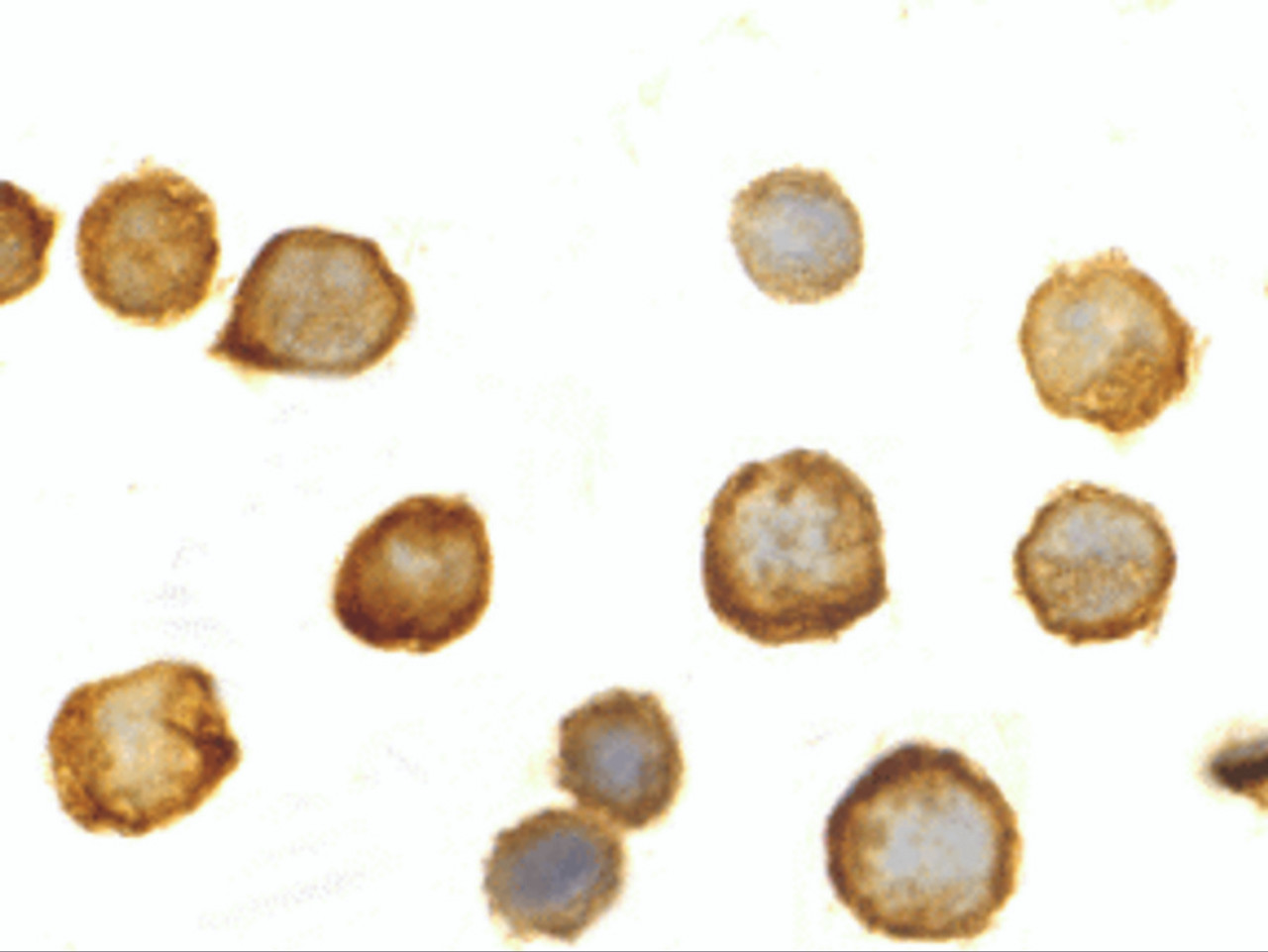 Immunocytochemistry of TLR5 in THP-1 cells with TLR5 antibody at 10 ug/mL.